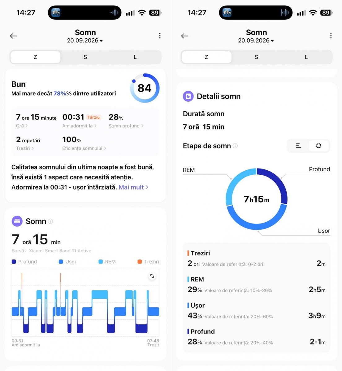 Xiaomi Smart Band 11 Active fitness tracker