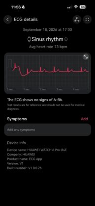 Huawei Watch 6 Pro Review: X-TAP 2.0 and Expedition Mode Define Huawei&rsquo;s New Premium Watch