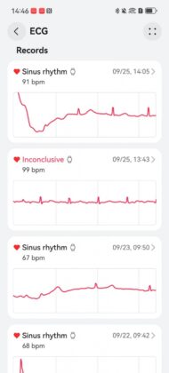 Huawei Watch D3 Review: Blood Pressure Tracking Before and After Exercise Takes Center Stage